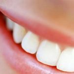 Un sorriso perfetto grazie a Glamsmile