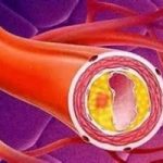 Scoperta molecola che frena infarto