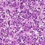 Nobel per la chimica al perfezionamento della microscopia ottica