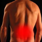 sciatica
