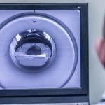 La più piccola macchina per la risonanza magnetica