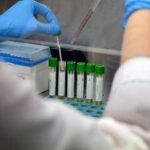 Allerta polio in Germania, virus selvaggio trovato in acque reflue ad Amburgo