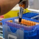 Fegato, un test per scoprire il rischio di gravi malattie entro 10 anni: lo studio