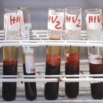 Aids, scoperti 'codici' del sistema immunitario per sospendere le cure