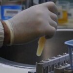 Malattia misteriosa Congo, Rezza: Letalità alta ma non c'è allerta globale