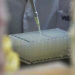 Epatiti A,B, C ed E: quale è in crescita e quale no, i dati