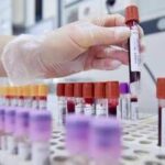 Tumore allo stomaco in stadio precoce, con immunoterapia 69% pazienti vivo a 3 anni