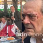Barillari picchiato da Depardieu in via Veneto: il fotoreporter in ospedale