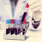 Nuovo tipo di diabete giovanile scoperto in Africa, la conferma che cambia la storia in un maxi stud...