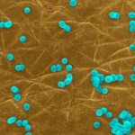 Da 'influenza intestinale' strascichi fino a 5 anni, lo studio