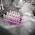 Rischio Long Covid, scoperta variante genetica che lo aumenta del 60%