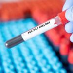 Mieloma multiplo, ok dell'Ue a Isatuximab per pazienti non eleggibili a trapianto