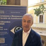 Malattie rare, oculista Rama: Sintomi aspecifici per cheratite da acanthamoeba