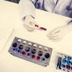 Cancro alla vescica, recidiva ridotta del 32% con immunoterapia durvalumab: lo studio