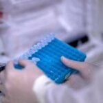 Colite ulcerosa, nuovi risultati positivi da monoclonale guselkumab