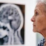 Giornata salute donne, Sin 'prendetevi cura anche della salute neurologica'