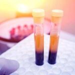 Farmaci, Sava (Sif Magazine): In plasmaderivati attenzione particolare a sicurezza