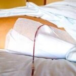 Fine vita, Sin: Cure palliative fondamentali per pazienti neurologici