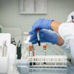 Mielofibrosi, ematologo: Con uso precoce momelotinib maggiore sopravvivenza