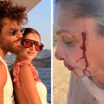 Can Yaman, la fidanzata Sara Bluma denuncia le violenze dell'ex. L'attore: Ti amo