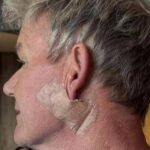 Gordon Ramsay: Operato per tumore della pelle
