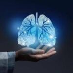 Cancro polmone, ok Ue a tislelizumab in neoadiuvante e adiuvante