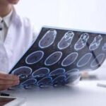 Giornata Sla, neurologi: Non resti confinata alla sperimentazione
