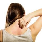 Dermatite atopica, raccolta firme per inserirla in Piano cronicità e Lea