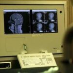 Medicina: Congresso Sin, neurologia tra innovazione, responsabilità e nuova organizzazione