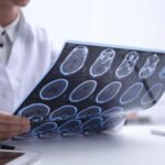 Salute, psicologa Borghi: Oltre la sclerosi multipla un percorso verso il futuro
