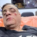 Cicalone, lo youtuber aggredito in metro a Roma: Infami veri