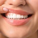 Diabete, parodontologi 'malattie gengivali complicano il tipo 2'