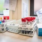 Medicina di laboratorio, 'un semplice esame per scoprire in anticipo le patologie'