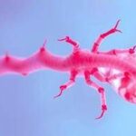 Miastenia, in Sardegna su mille pazienti stimati solo metà nel registro