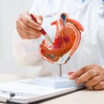 Tumore allo stomaco, pazienti: Diagnosi precoce per meno di 1 su 5, migliorare percorsi