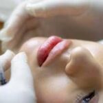 Boom di abusi nella medicina estetica: l'allarme dei medici e i consigli per difendersi