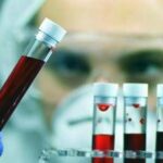 Leucemia linfatica cronica, con zanubrutinib sopravvivenza al 74% a 6 anni