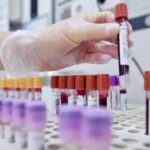 Allarme oncologi: - 50% trial in Europa in 10 anni mentre Cina accelera
