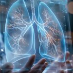 Cancro aggressivo al polmone, con mix di farmaci biologici raddoppia efficacia senza chemio