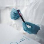 Epatite A in forte crescita in Italia: Lazio, Campania e Puglia le regioni con più casi
