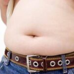 Obesità, allarme ictus anche nei giovani: peso in eccesso moltiplica il rischio