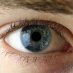 Salute, esperti: Cheratocono difetto visivo complesso, correzione non solo con occhiali