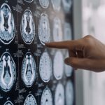 Tumori: glioma, Fda riconosce come farmaco orfano l'isotopo rame-64 sviluppato nelle Marche