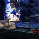 Malattia cronica da trapianto contro l'ospite, via libera Ue a belumosudil ﻿